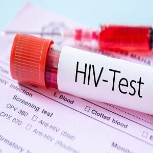 HIV & Herpes